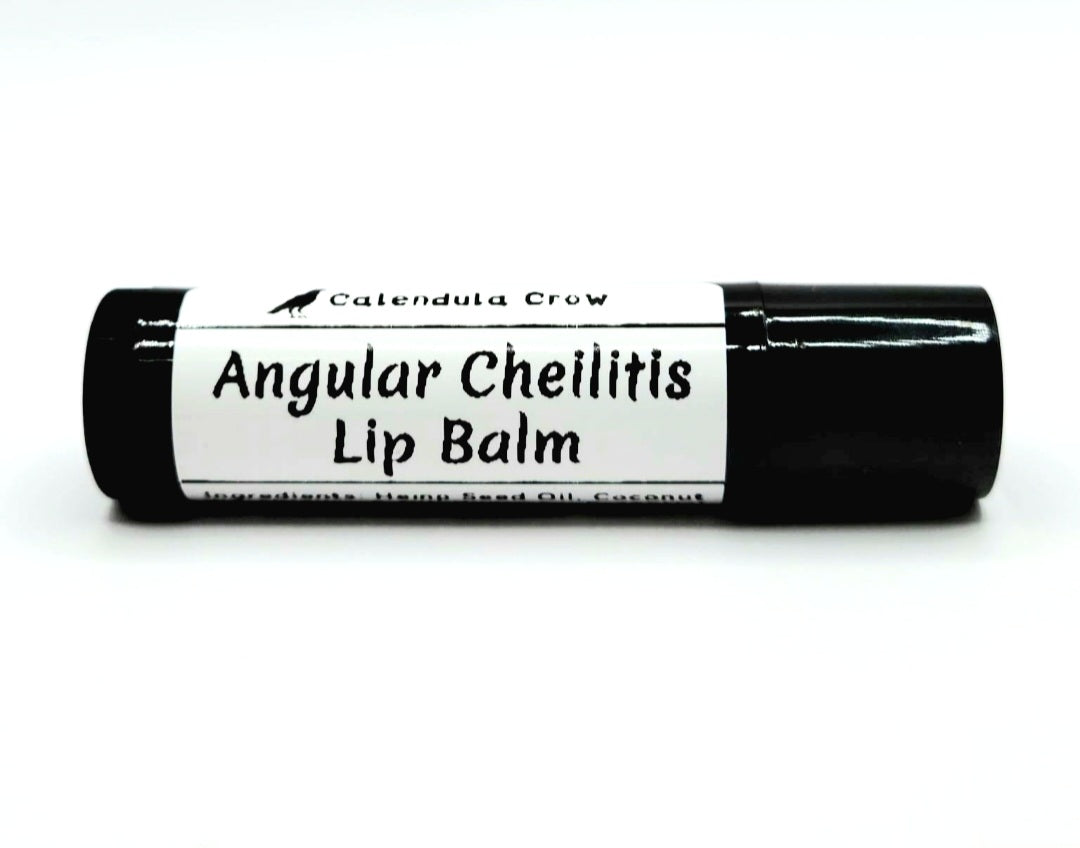 ANGULAR CHEILITIS LIP BALM